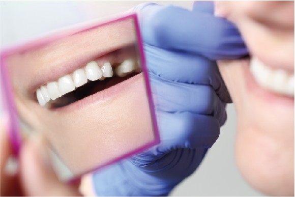 immagine 04 | Montagna Studi Dentistici | Dentista a Bovolone