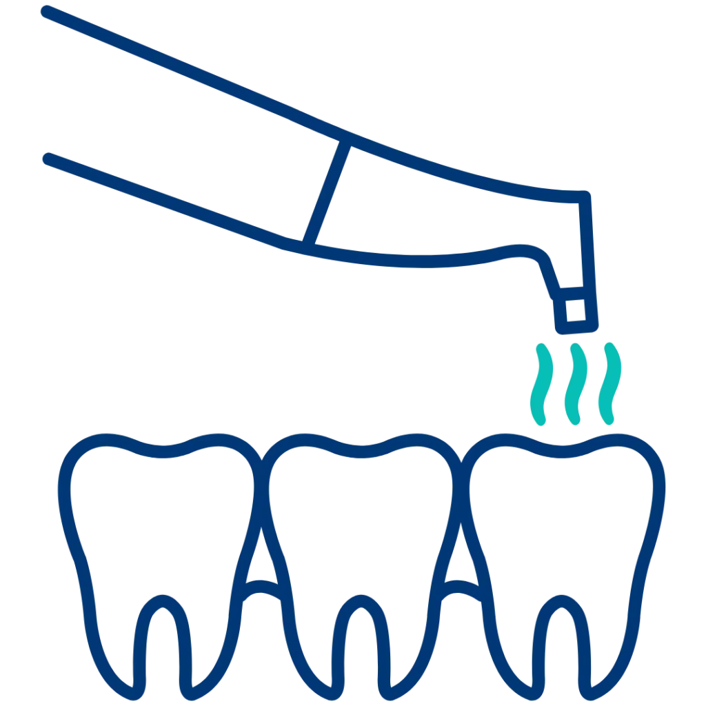 Endodonzia 25 Air flow Igiene orale con micro polveri