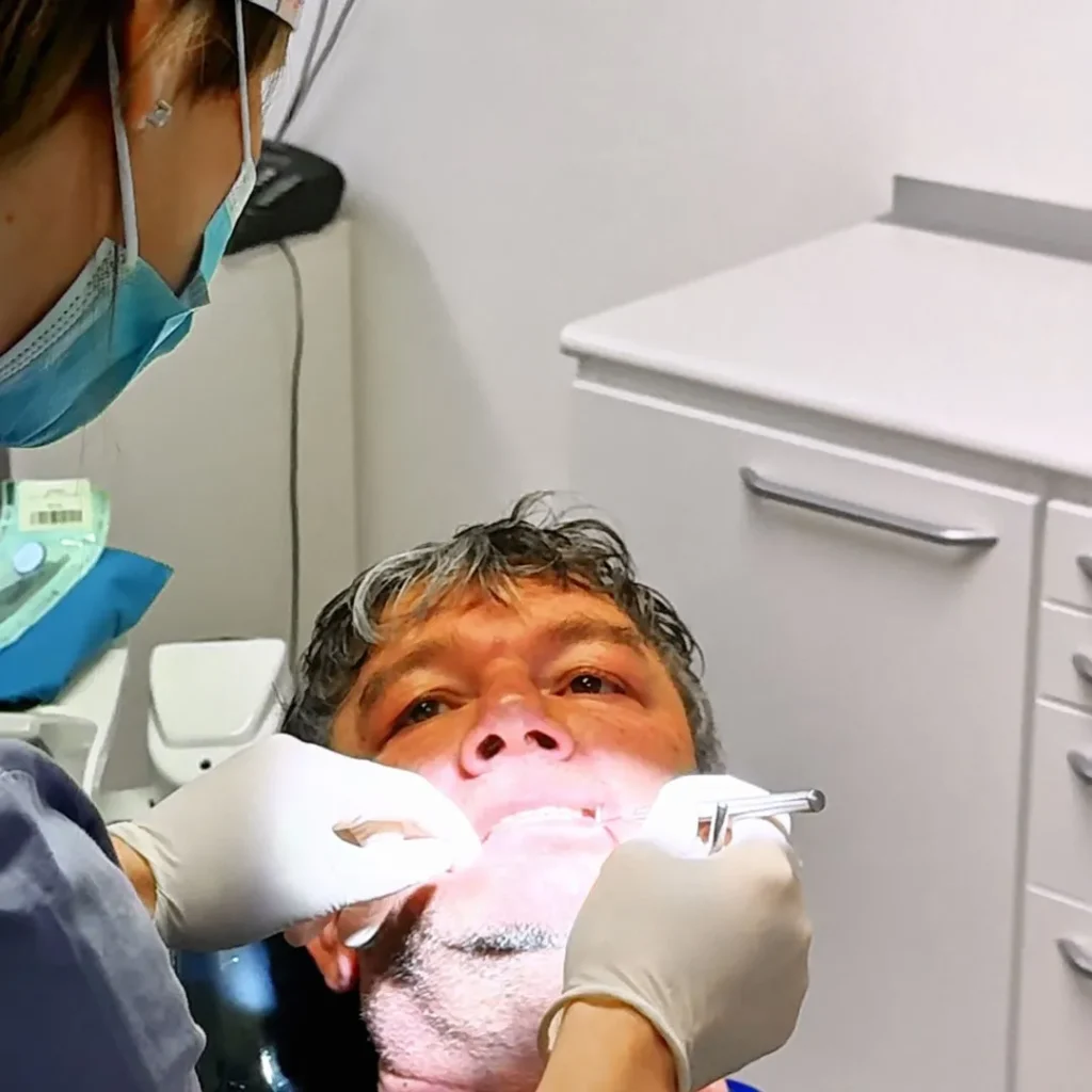 Endodonzia 16 devitalizzazione dente a Verona
