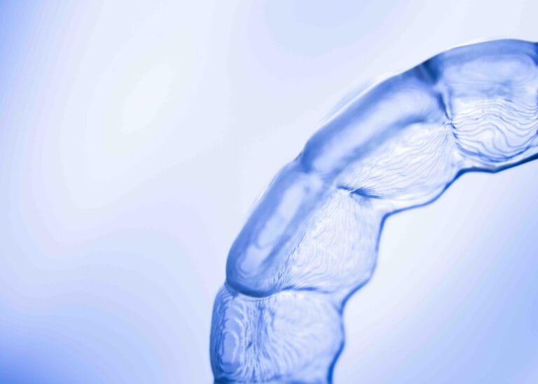 Blog 3 Odontoiatria estetica