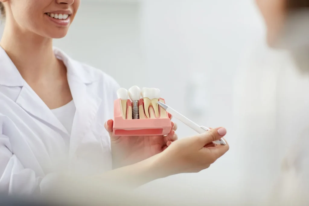 Quanto tempo ci vuole per fare un impianto dentale? 1 quanto tempo ci vuole per fare un impianto dentale