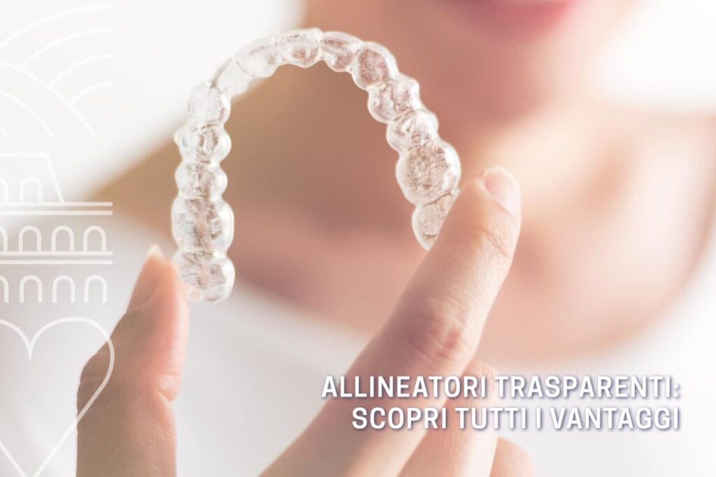 allineatori-trasparenti