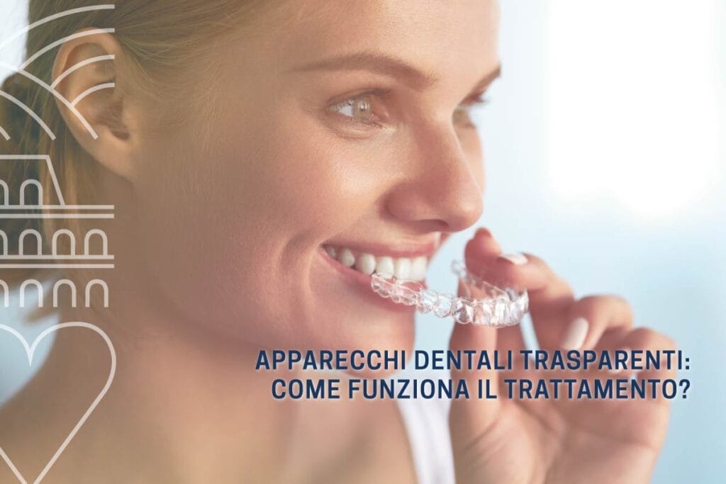 apparecchi-dentali-trasparenti