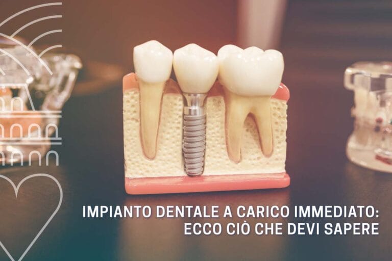 Blog 15 impianto-dentale-a-carico-immediato