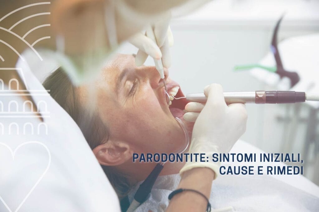 parodontite sintomi iniziali