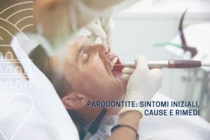 parodontite sintomi iniziali